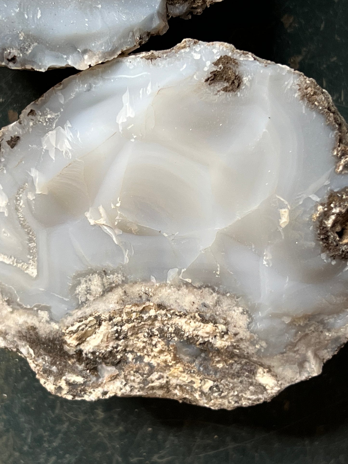 Choya Nodule