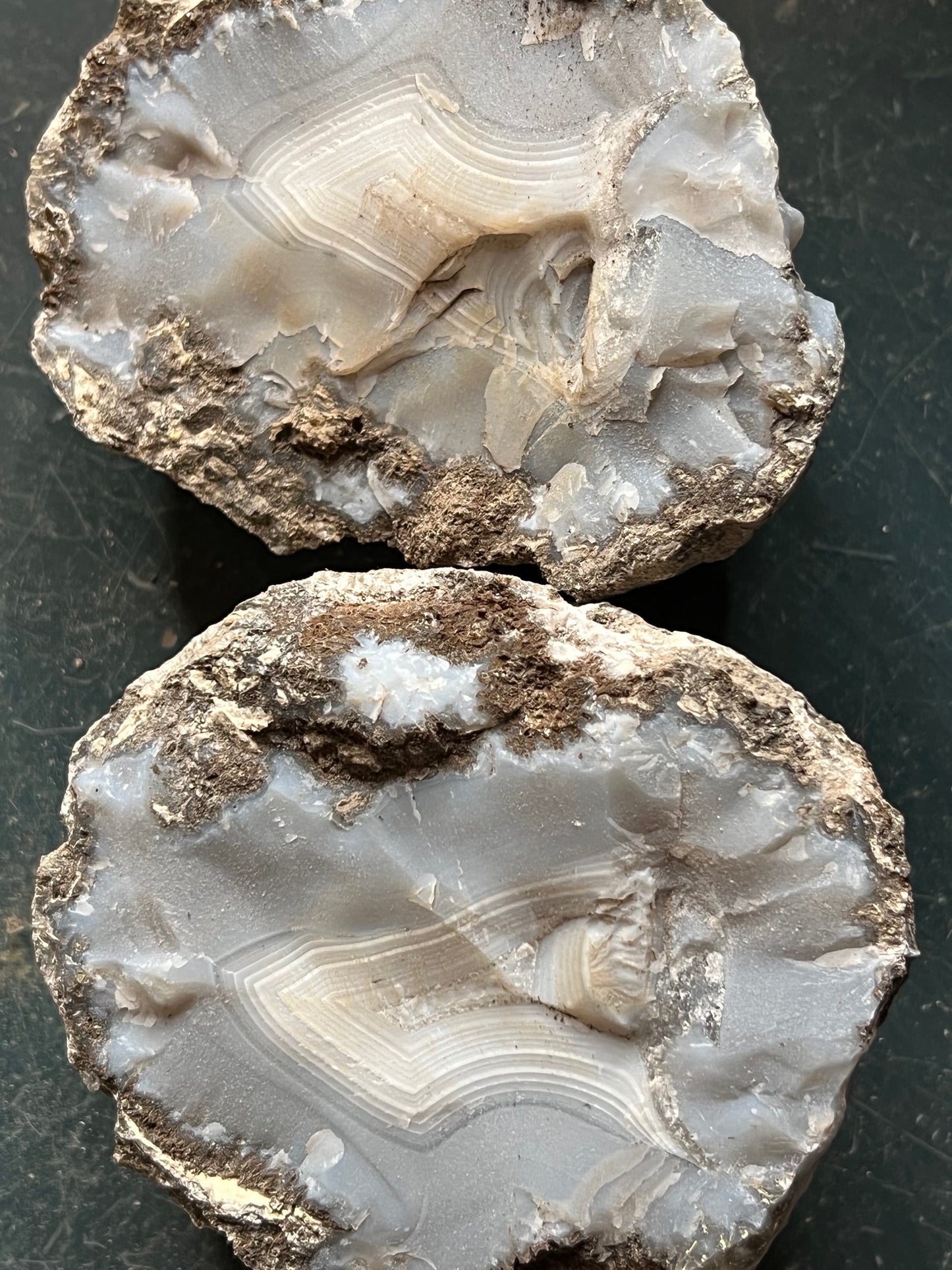Choya Nodule